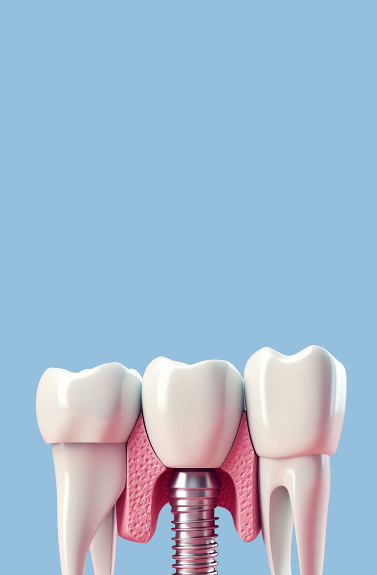 陶瓷烤瓷义齿nODM/OEM/ 代工/贴牌